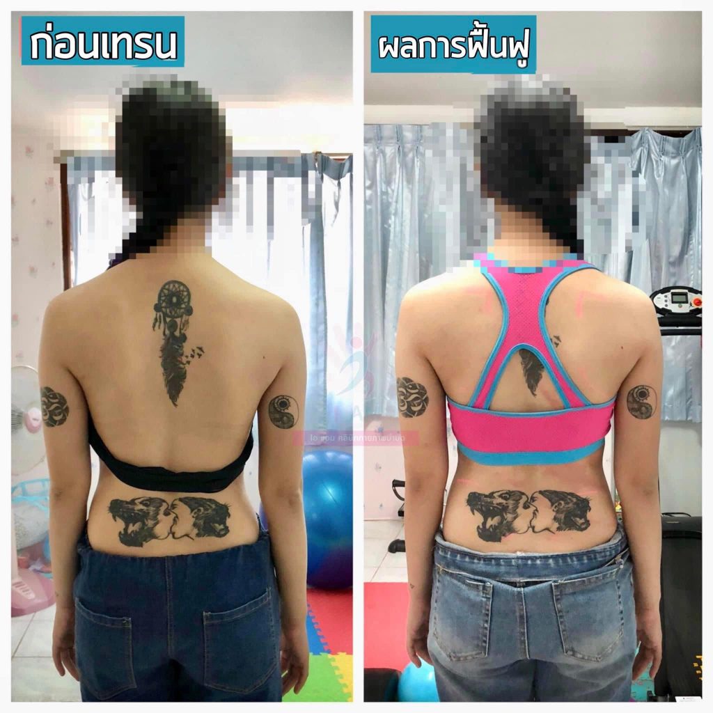 คลินิกกายภาพบำบัด พะเยา